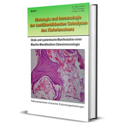 Histology & Immunology of the cavity-forming osteolysis of the jawbone