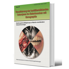Band IV „Visualisierung der kavitätenbildenden Osteolysen im Kieferknochen mit Sonographie“ 