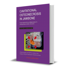Volume I - IV (English) "Cavitational Osteonecrosis in Jawbone".